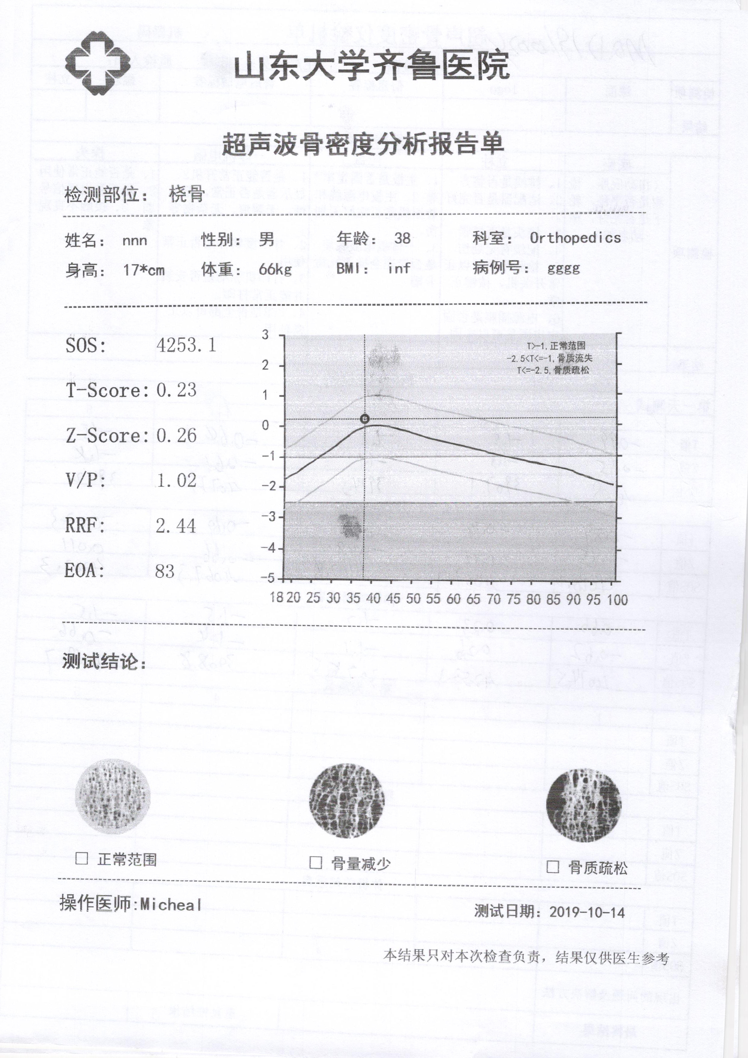 便携式骨密度仪小型款生产厂家介绍：怎么做骨密度检查用什么仪器？