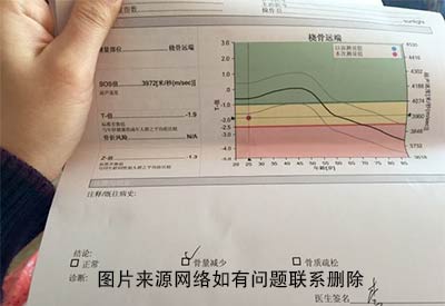 宁夏骨密度检测仪厂家直销看看医生是如何解读骨密度检测报告单上的数值