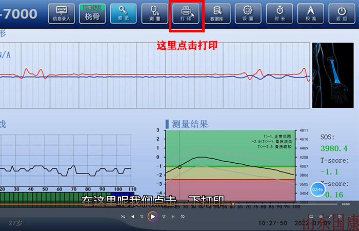 骨密度仪品牌详细介绍：医院在打印结果是该如何操作？内附改打印设置！