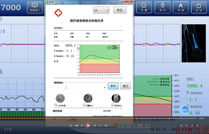 骨密度仪品牌详细介绍：医院在打印结果是该如何操作？内附改打印设置！