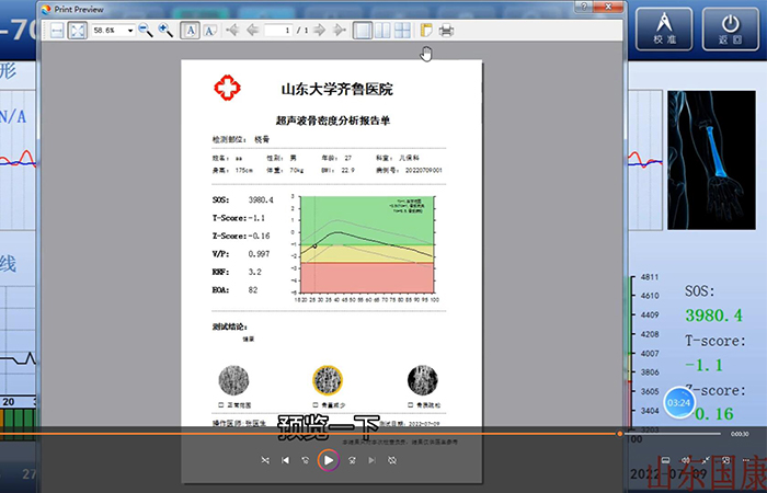 骨密度仪品牌详细介绍：医院在打印结果是该如何操作？内附改打印设置！