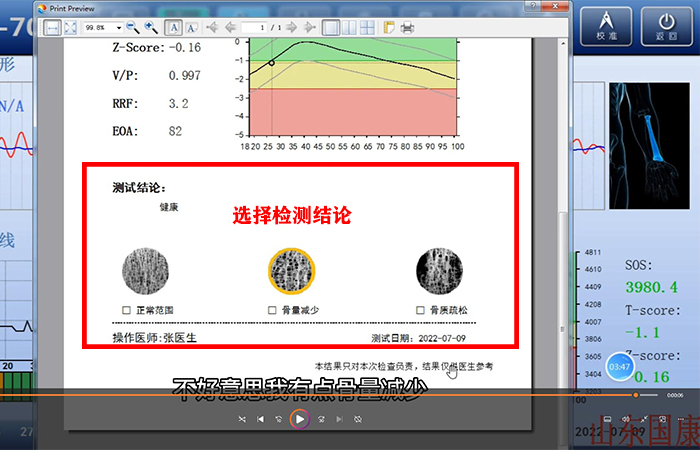 骨密度仪品牌详细介绍：医院在打印结果是该如何操作？内附改打印设置！