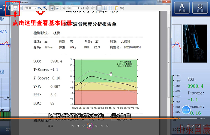 骨密度仪品牌详细介绍：医院在打印结果是该如何操作？内附改打印设置！